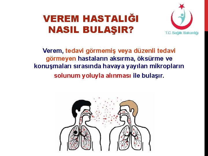 VEREM HASTALIĞI NASIL BULAŞIR? Verem, tedavi görmemiş veya düzenli tedavi görmeyen hastaların aksırma, öksürme