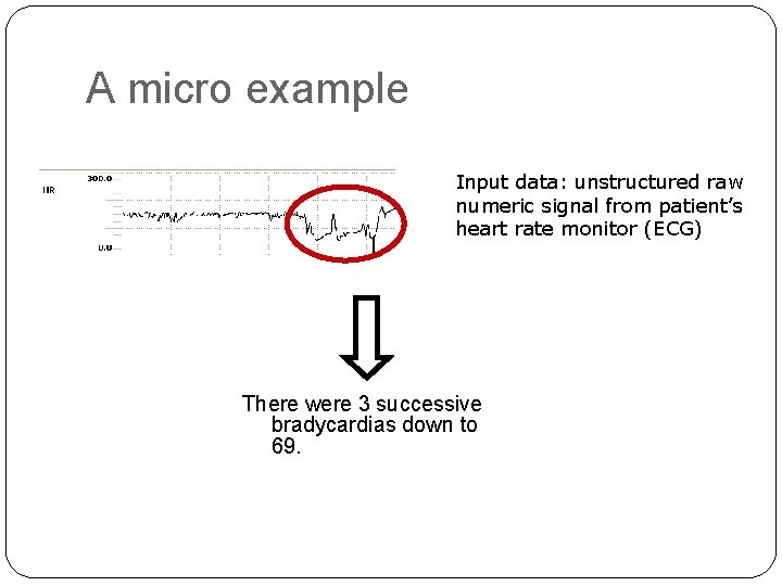 A micro example Input data: unstructured raw numeric signal from patient’s heart rate monitor