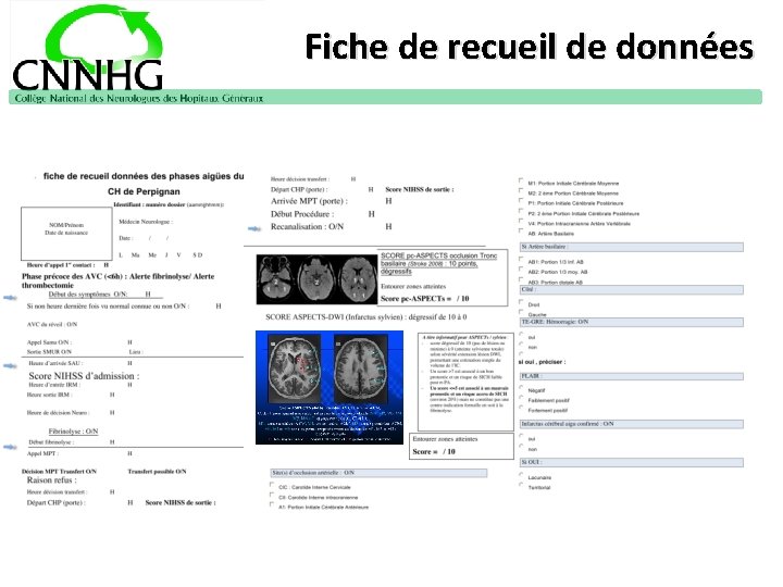 Fiche de recueil de données 