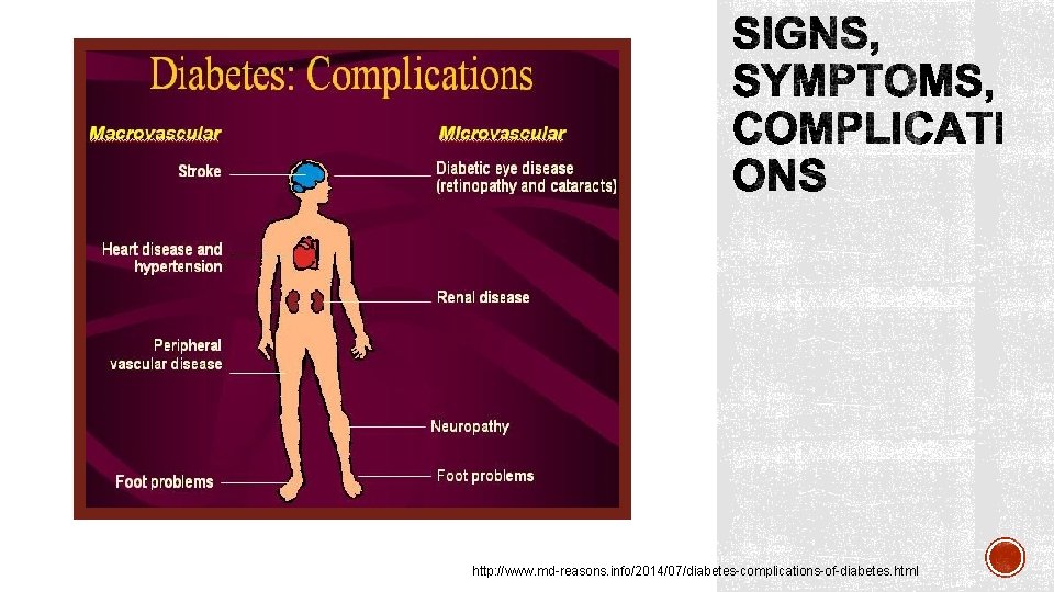 http: //www. md-reasons. info/2014/07/diabetes-complications-of-diabetes. html 