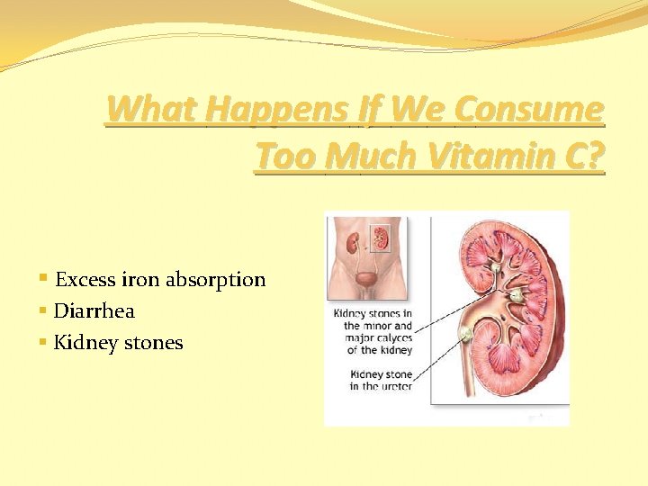 What Happens If We Consume Too Much Vitamin C? § Excess iron absorption §