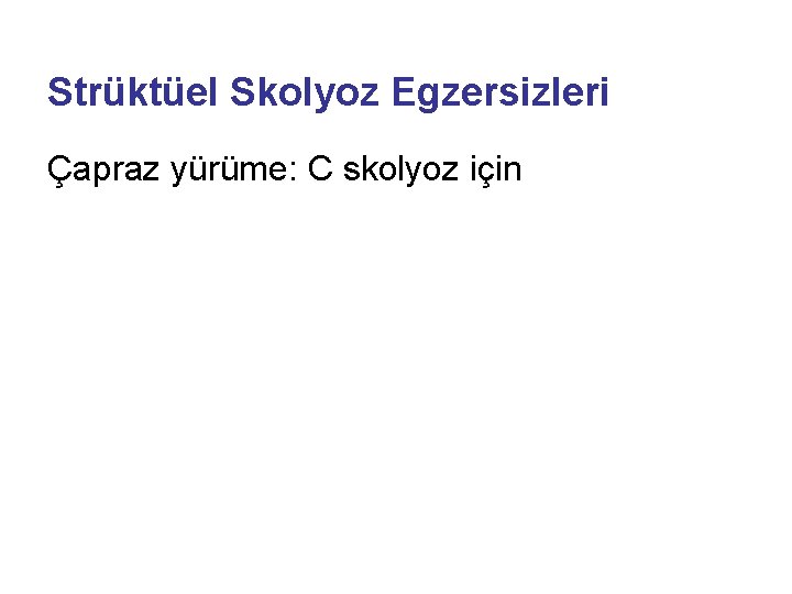 Strüktüel Skolyoz Egzersizleri Çapraz yürüme: C skolyoz için 