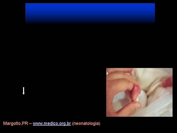 Margotto, PR – www. medico. org. br (neonatologia) 