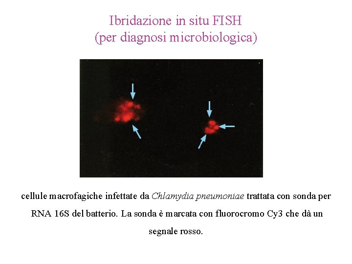 Ibridazione in situ FISH (per diagnosi microbiologica) cellule macrofagiche infettate da Chlamydia pneumoniae trattata