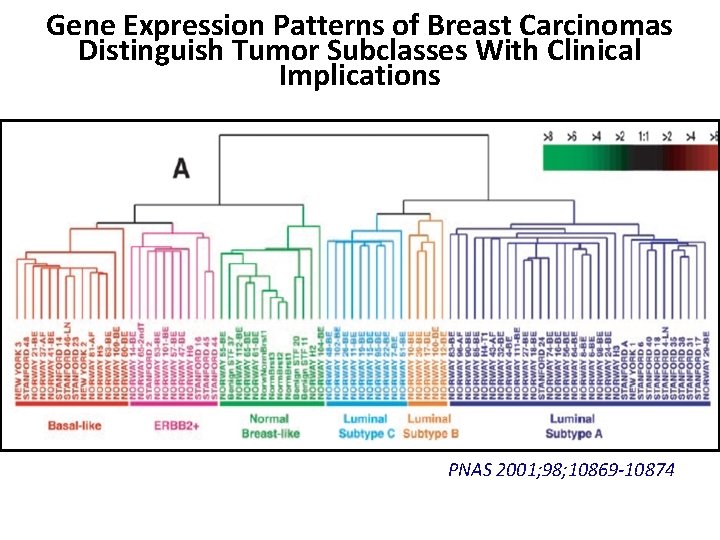 Gene Expression Patterns of Breast Carcinomas Distinguish Tumor Subclasses With Clinical Implications PNAS 2001;