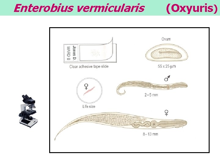 Enterobius vermicularis (Oxyuris) 