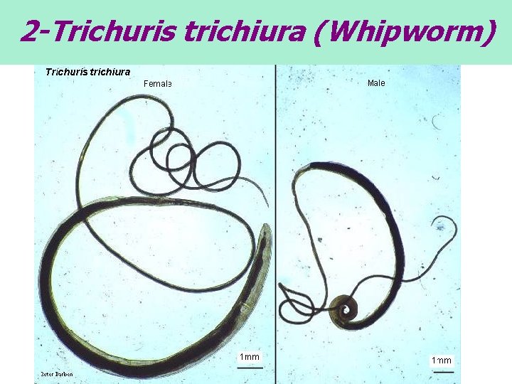 2 -Trichuris trichiura (Whipworm) 