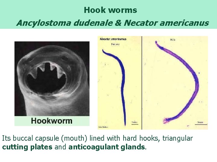 Hook worms Ancylostoma dudenale & Necator americanus Its buccal capsule (mouth) lined with hard