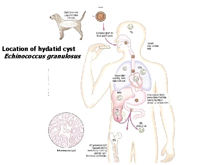 Location of hydatid cyst Echinococcus granulosus 