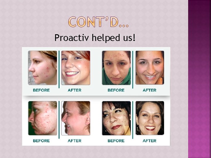 Proactiv helped us!  Proactiv helped us!