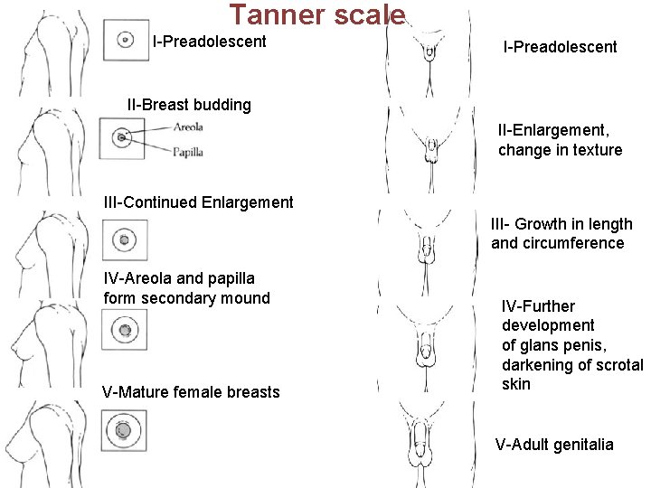Tanner scale I-Preadolescent II-Breast budding II-Enlargement, change in texture III-Continued Enlargement III- Growth in