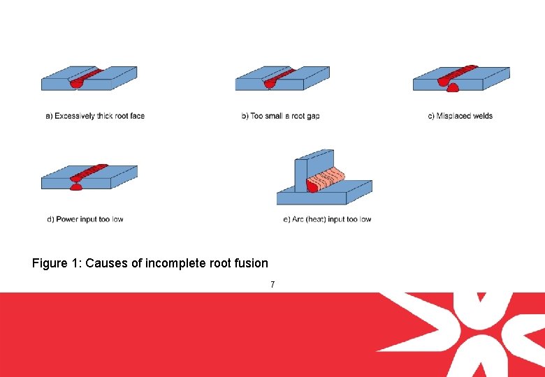 Figure 1: Causes of incomplete root fusion 7 