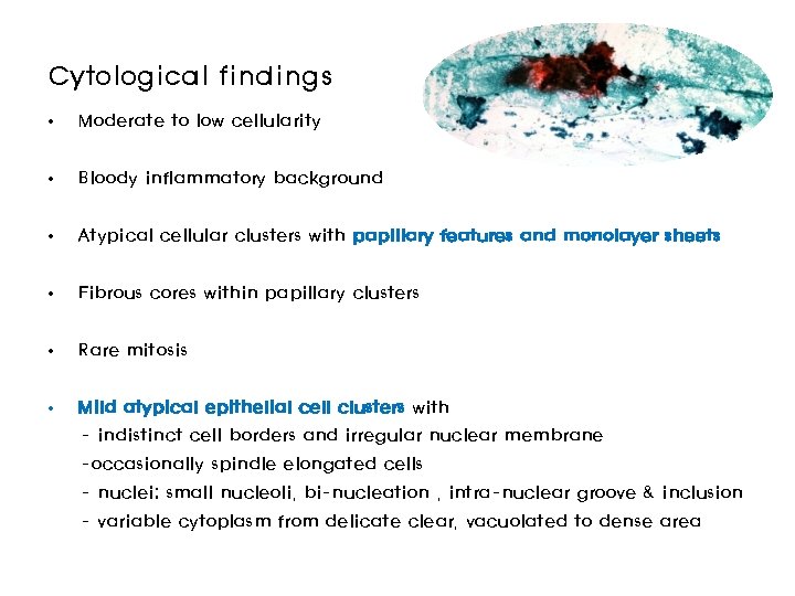 Cytological findings • Moderate to low cellularity • Bloody inflammatory background • Atypical cellular