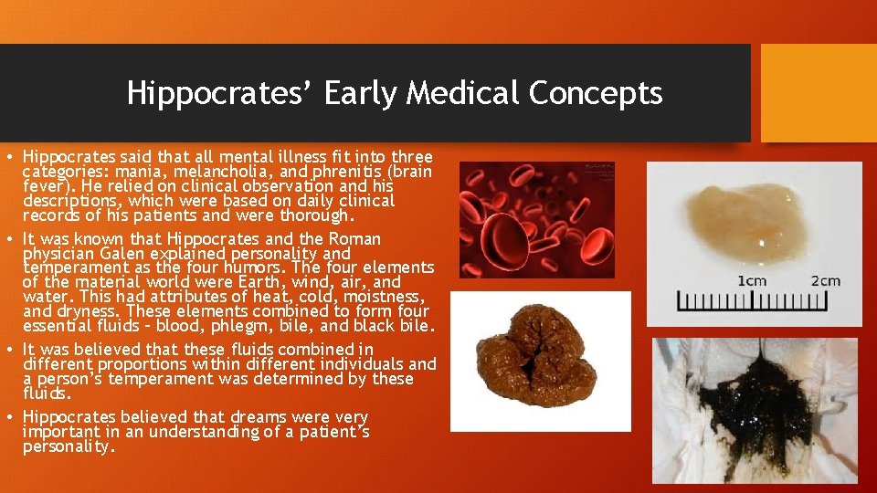 Hippocrates’ Early Medical Concepts • Hippocrates said that all mental illness fit into three