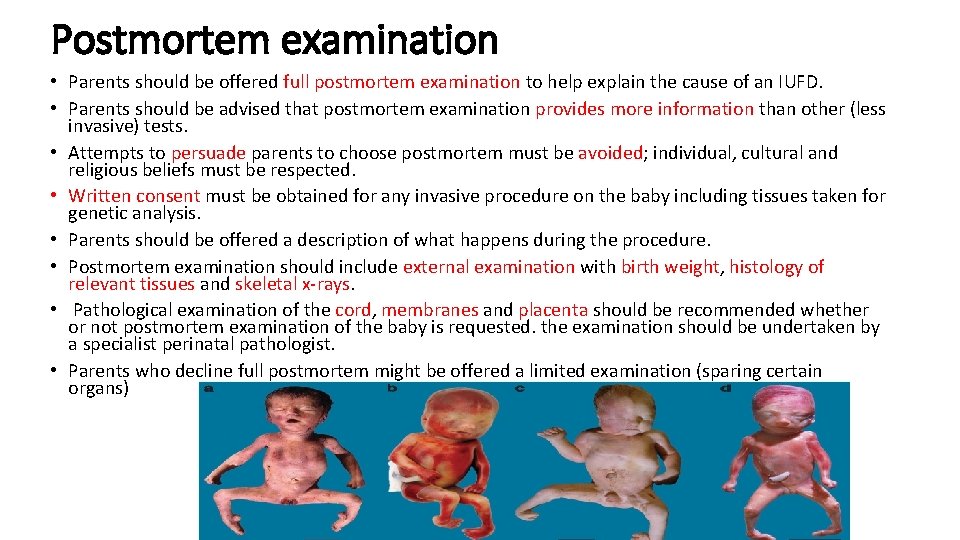 Postmortem examination • Parents should be offered full postmortem examination to help explain the