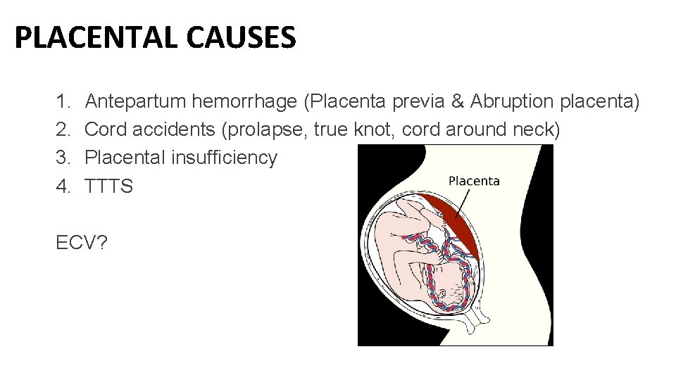 PLACENTAL CAUSES 1. 2. 3. 4. Antepartum hemorrhage (Placenta previa & Abruption placenta) Cord