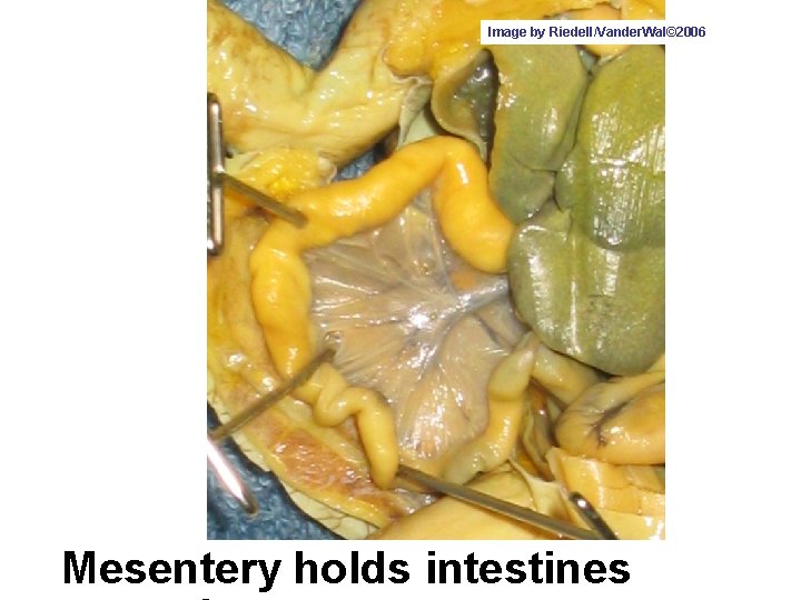 Image by Riedell/Vander. Wal© 2006 Mesentery holds intestines 