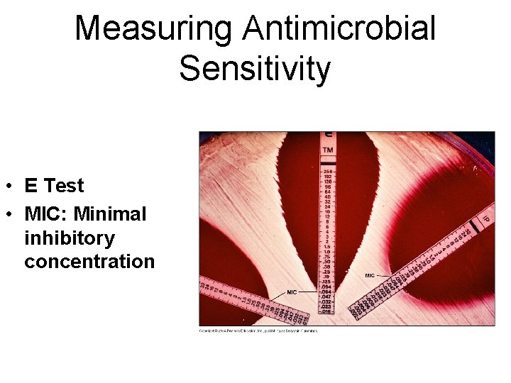 Measuring Antimicrobial Sensitivity • E Test • MIC: Minimal inhibitory concentration  Measuring Antimicrobial Sensitivity • E Test • MIC: Minimal inhibitory concentration