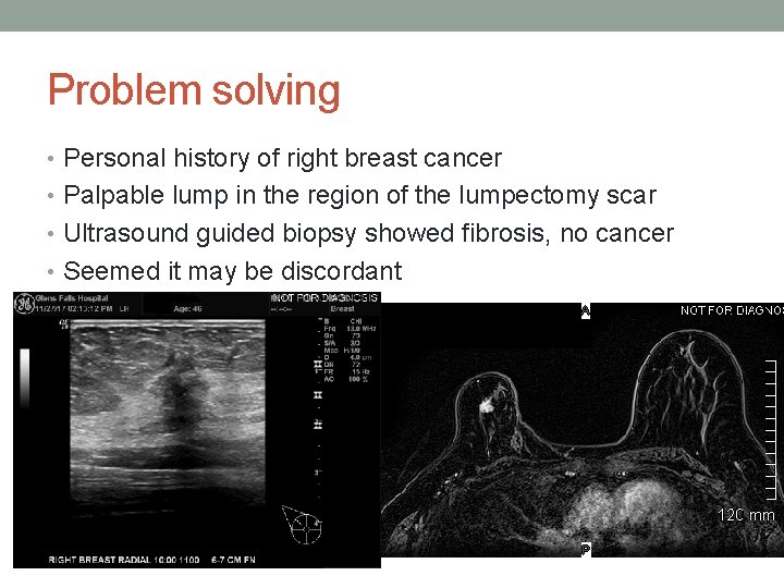 Problem solving • Personal history of right breast cancer • Palpable lump in the