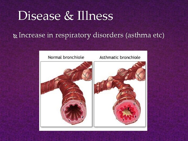 Disease & Illness Increase in respiratory disorders (asthma etc) 
