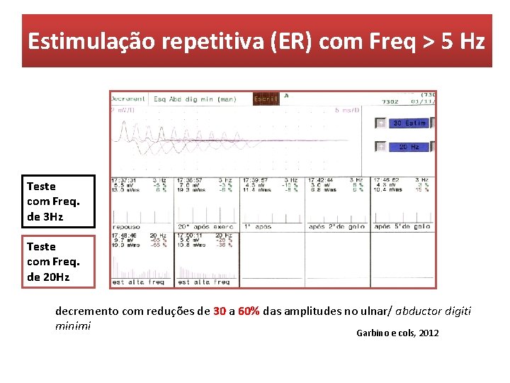 Estimulação repetitiva (ER) com Freq > 5 Hz Teste com Freq. de 3 Hz