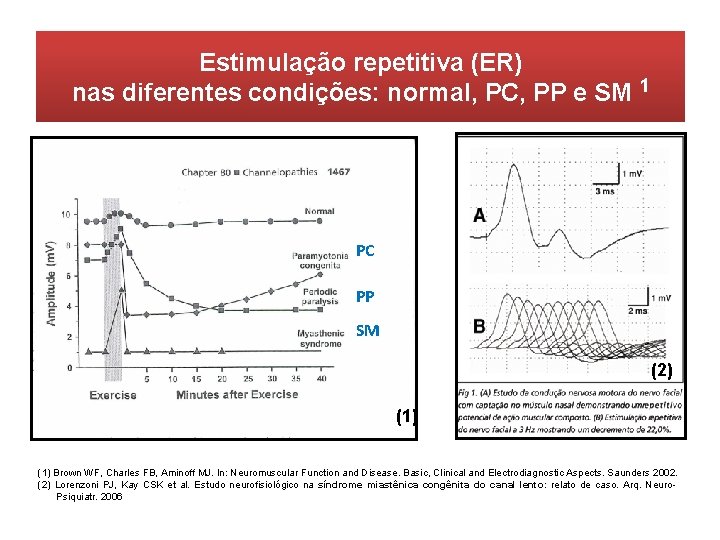 Estimulação repetitiva (ER) nas diferentes condições: normal, PC, PP e SM 1 PC PP