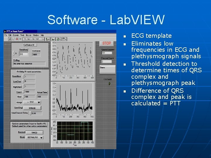 Software - Lab. VIEW n n ECG template Eliminates low frequencies in ECG and