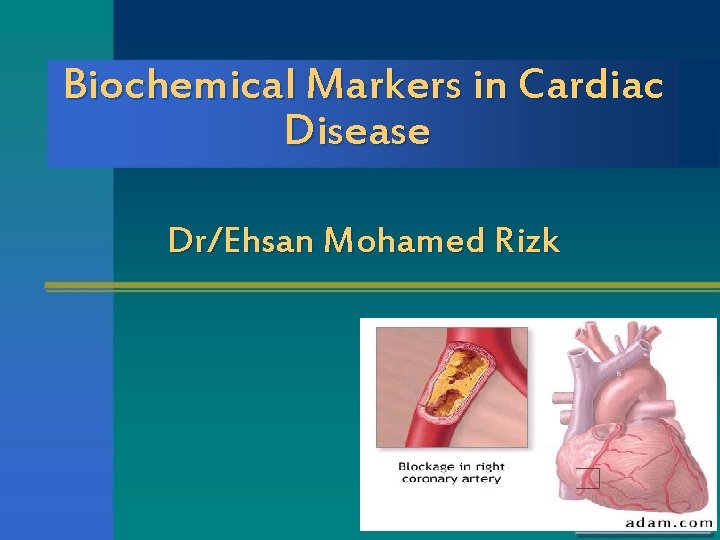 Biochemical Markers in Cardiac Disease Dr/Ehsan Mohamed Rizk 