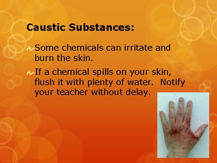 Caustic Substances: Some chemicals can irritate and burn the skin. If a chemical spills