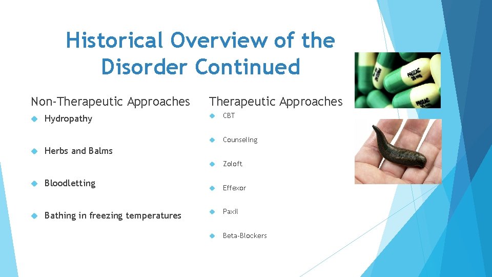 Historical Overview of the Disorder Continued Non-Therapeutic Approaches Hydropathy Therapeutic Approaches CBT Counseling Zoloft Historical Overview of the Disorder Continued Non-Therapeutic Approaches Hydropathy Therapeutic Approaches CBT Counseling Zoloft