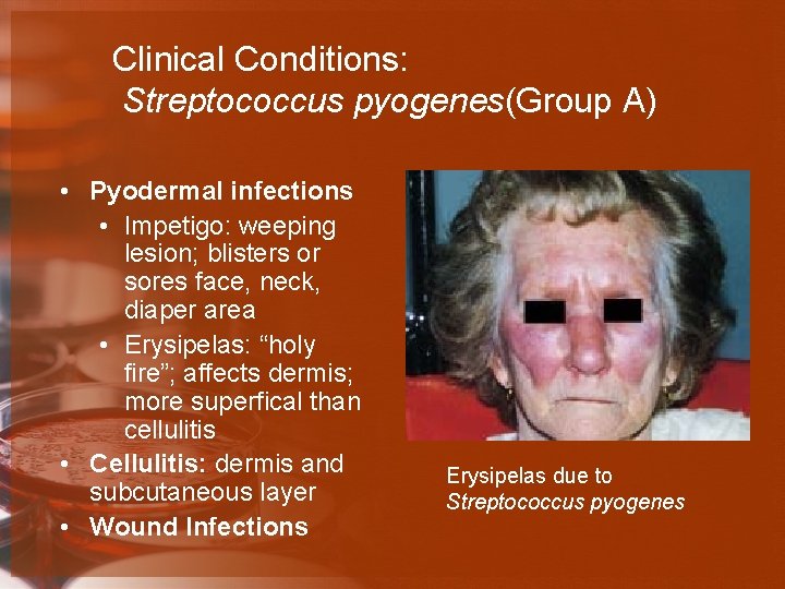 Clinical Conditions: Streptococcus pyogenes(Group A) • Pyodermal infections • Impetigo: weeping lesion; blisters or