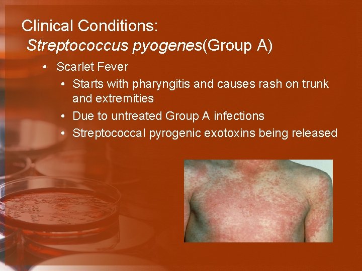 Clinical Conditions: Streptococcus pyogenes(Group A) • Scarlet Fever • Starts with pharyngitis and causes