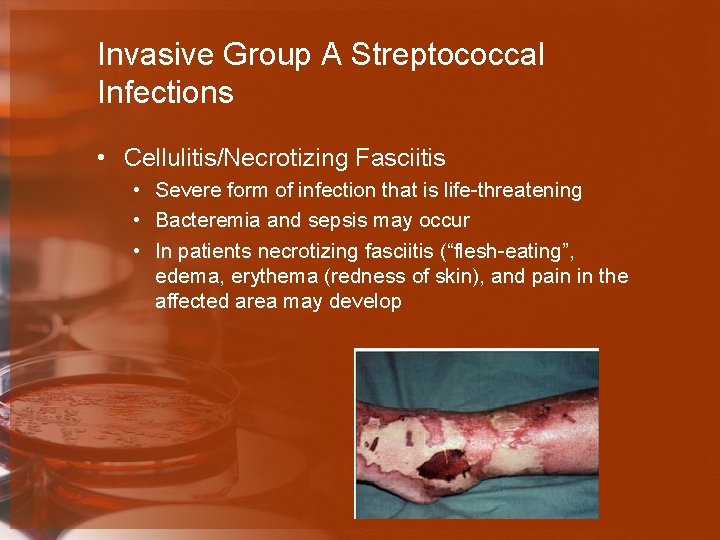 Invasive Group A Streptococcal Infections • Cellulitis/Necrotizing Fasciitis • Severe form of infection that