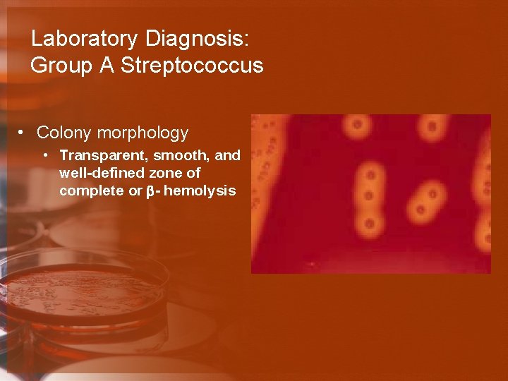 Laboratory Diagnosis: Group A Streptococcus • Colony morphology • Transparent, smooth, and well-defined zone