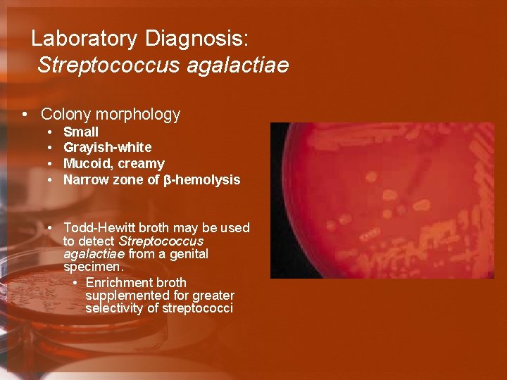 Laboratory Diagnosis: Streptococcus agalactiae • Colony morphology • • Small Grayish-white Mucoid, creamy Narrow