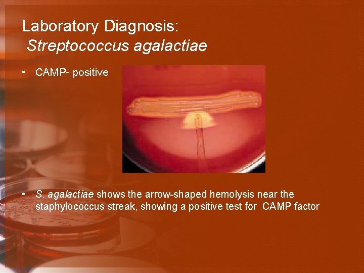 Laboratory Diagnosis: Streptococcus agalactiae • CAMP- positive • S. agalactiae shows the arrow-shaped hemolysis