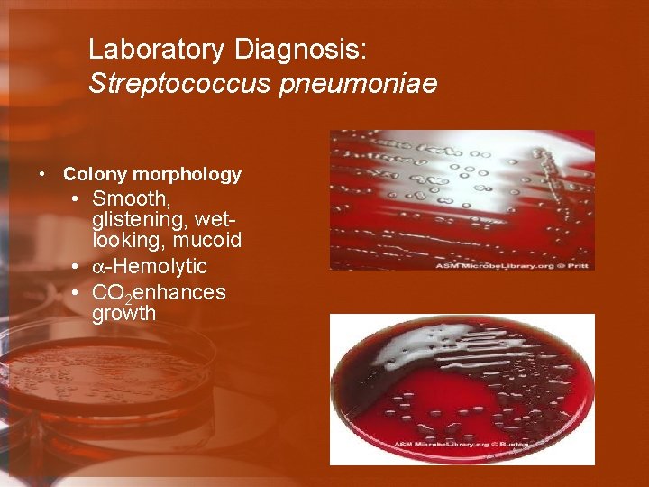 Laboratory Diagnosis: Streptococcus pneumoniae • Colony morphology • Smooth, glistening, wetlooking, mucoid • -Hemolytic