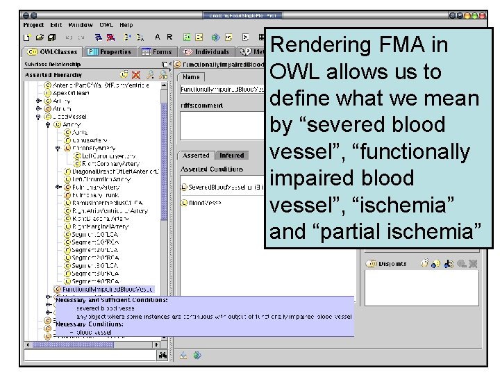 Rendering FMA in OWL allows us to define what we mean by “severed blood