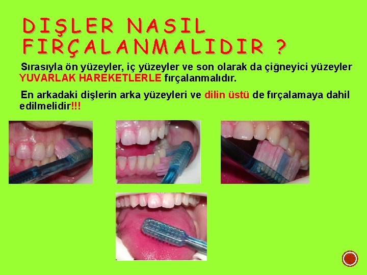 DIŞLER NASIL FIRÇALANMALIDIR ? Sırasıyla ön yüzeyler, iç yüzeyler ve son olarak da çiğneyici