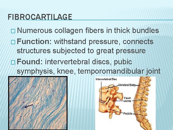 FIBROCARTILAGE � Numerous collagen fibers in thick bundles � Function: withstand pressure, connects structures FIBROCARTILAGE � Numerous collagen fibers in thick bundles � Function: withstand pressure, connects structures