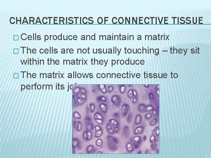 CHARACTERISTICS OF CONNECTIVE TISSUE � Cells produce and maintain a matrix � The cells CHARACTERISTICS OF CONNECTIVE TISSUE � Cells produce and maintain a matrix � The cells