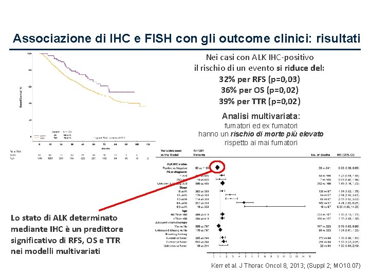 Associazione di IHC e FISH con gli outcome clinici: risultati Nei casi con ALK