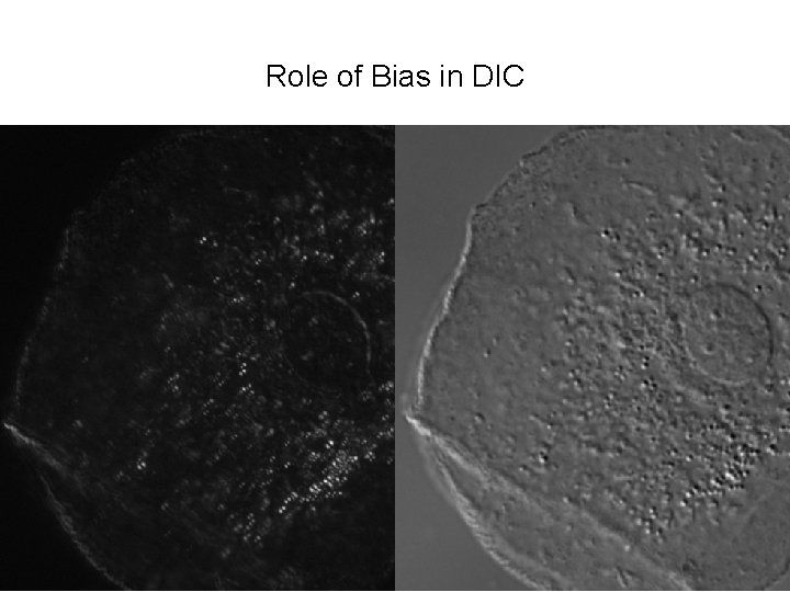 Role of Bias in DIC 