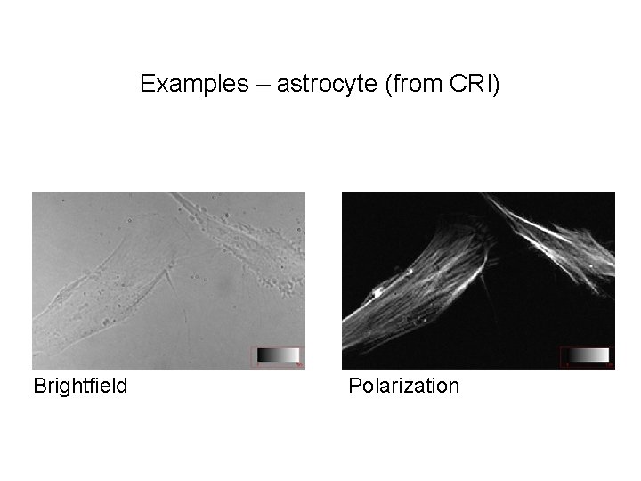 Examples – astrocyte (from CRI) Brightfield Polarization 