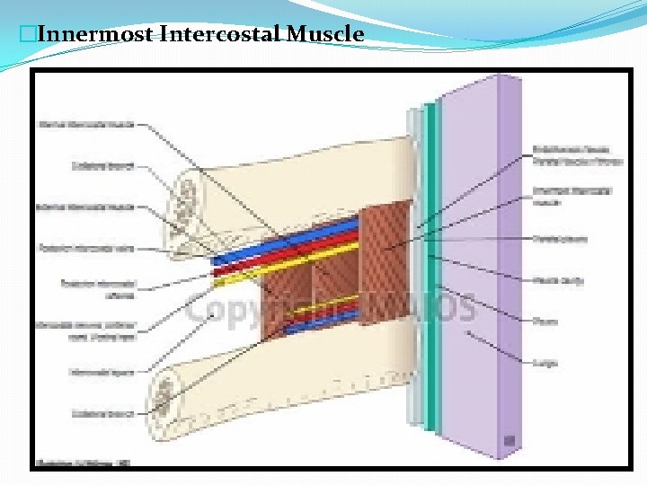 �Innermost Intercostal Muscle 