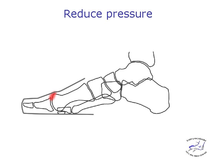 Reduce pressure 