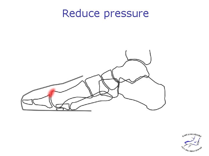 Reduce pressure 