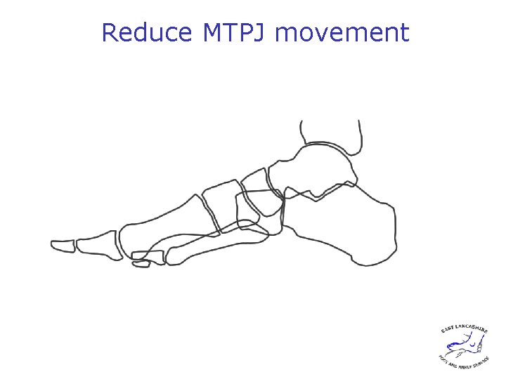 Reduce MTPJ movement 