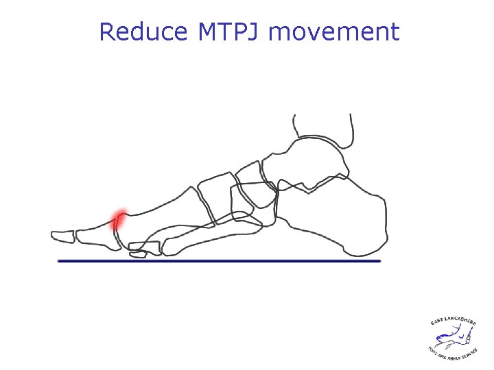 Reduce MTPJ movement 