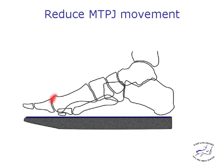 Reduce MTPJ movement 